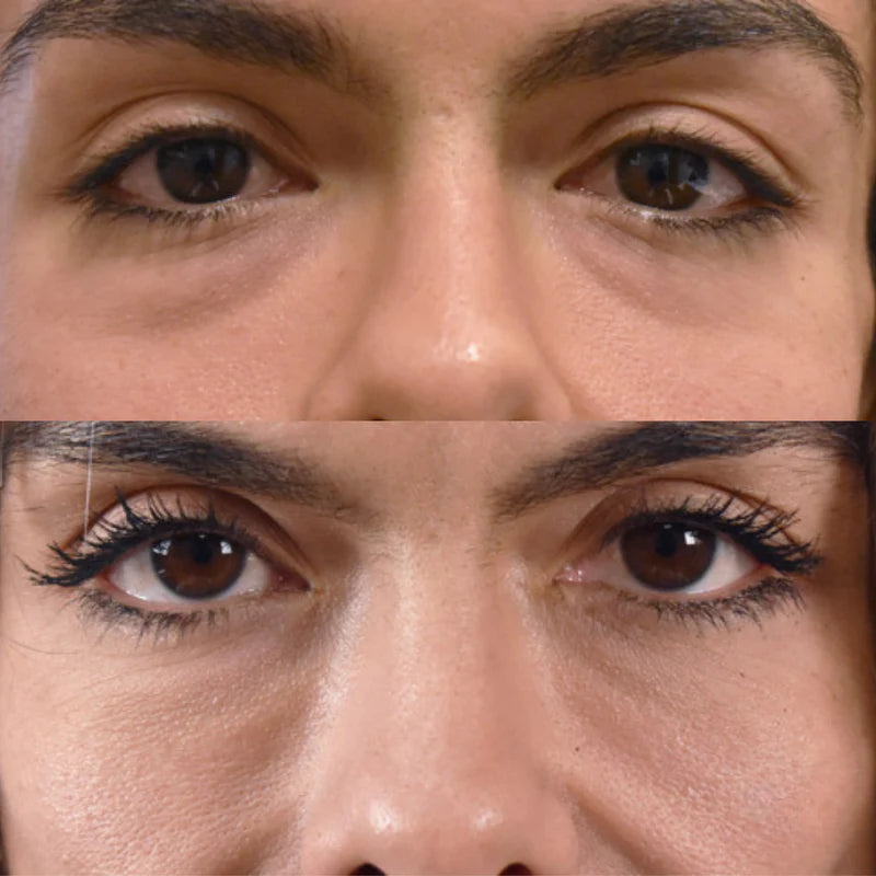 Glameskin™ 24K Guld ögonmask